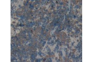 Used in DAB staining on fromalin fixed paraffin- embedded Kidney tissue (KLRK1 antibody  (AA 75-215))
