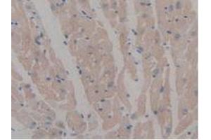 IHC-P analysis of Mouse Heart Tissue, with DAB staining. (MAP6 antibody  (AA 177-387))