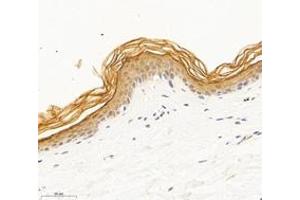Immunohistochemistry (Paraffin-embedded Sections) (IHC (p)) image for anti-Desmoplakin (DSP) antibody (ABIN7073719)