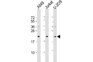 All lanes : Anti-FP24 Antibody (N-Term) at 1:1000-1:2000 dilution Lane 1: A549 whole cell lysate Lane 2: Jurkat whole cell lysate Lane 3: U-2OS whole cell lysate Lysates/proteins at 20 μg per lane.