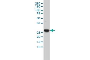 CA3 monoclonal antibody (M02), clone 4A12-1A3 Western Blot analysis of CA3 expression in K-562 . (CA3 antibody  (AA 1-260))