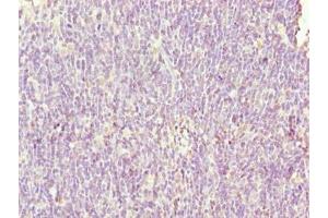 Immunohistochemistry of paraffin-embedded human thymus tissue using ABIN7169483 at dilution of 1:100 (SH3BGRL3 antibody  (AA 2-93))
