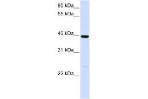 ADH1A antibody used at 1 ug/ml to detect target protein. (ADH1A antibody)