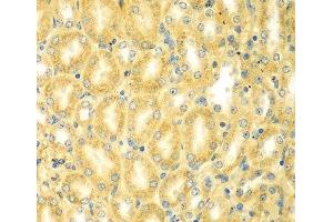 Immunohistochemistry of paraffin-embedded Mouse kidney using PDE4DIP Polyclonal Antibody at dilution of 1:100 (40x lens). (PDE4DIP antibody)