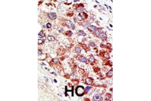 Immunohistochemistry (IHC) image for anti-Cbl proto-oncogene C (CBLC) antibody (ABIN2996831) (CBLC antibody)
