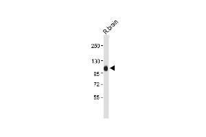 Anti-G Antibody (Center) at 1:2000 dilution + Rat brain whole tissue lysate Lysates/proteins at 20 μg per lane. (MAG antibody  (AA 439-466))