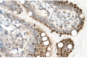 Rabbit Anti-ZFP1 Antibody Catalog Number: ARP31586 Paraffin Embedded Tissue: Human Intestine Cellular Data: Epithelial cells of intestinal villas Antibody Concentration: 4. (Zfp-1 antibody  (N-Term))