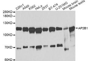 Western blot analysis of extracts of various cell lines, using AP2B1 antibody (ABIN1871002) at 1:1000 dilution. (AP2B1 antibody)