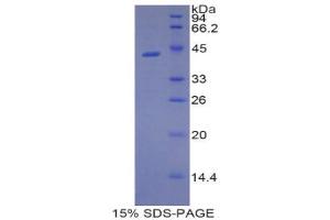 SDS-PAGE (SDS) image for Lipocalin 9 (LCN9) (AA 33-163) protein (His tag,GST tag) (ABIN2123188)