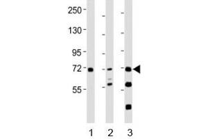 Western blot testing of SYK antibody at 1:2000 dilution. (SYK antibody  (AA 268-305))