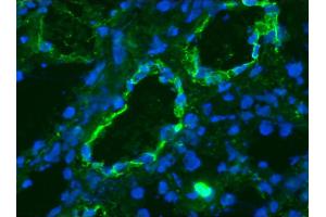 Image no. 2 for anti-K-Cadherin (CDH6) antibody (ABIN335402) (CDH6 antibody)