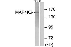 Western blot analysis of extracts from COLO cells, using MAP4K6 antibody. (MAP4K6 antibody  (Internal Region))