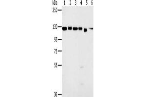 Gel: 6 % SDS-PAGE, Lysate: 40 μg, Lane 1-6: 293T cells, K562 cells, hela cells, 231 cells, Jurkat cells, NIH/3T3 cells, Primary antibody: ABIN7130189(MATR3 Antibody) at dilution 1/500, Secondary antibody: Goat anti rabbit IgG at 1/8000 dilution, Exposure time: 3 seconds (MATR3 antibody)