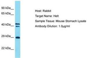 HELT antibody  (AA 138-187)