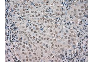 Image no. 3 for anti-Budding Uninhibited By Benzimidazoles 1 Homolog beta (Yeast) (BUB1B) antibody (ABIN1497000) (BUB1B antibody)