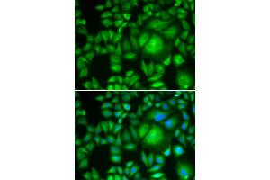 Immunofluorescence analysis of HeLa cells using CBR1 antibody (ABIN5973163). (CBR1 antibody)
