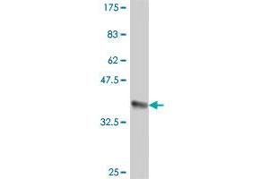 Western Blot detection against Immunogen (36. (GIPC1 antibody  (AA 61-158))