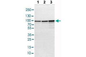 Western blot analysis of Lane 1: NIH-3T3 cell lysate, Lane 2: NBT-II cell lysate, Lane 3: PC12 cell lysate with ACO2 polyclonal antibody . (ACO2 antibody  (AA 544-693))