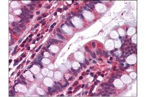 Immunohistochemistry Image: Human Small Intestine: Formalin-Fixed, Paraffin-Embedded (FFPE) (Serotonin Receptor 3A antibody  (Internal Region))