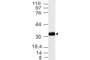 Image no. 1 for anti-Uncoupling Protein 3 (Mitochondrial, Proton Carrier) (UCP3) (AA 1-300) antibody (ABIN5027619)
