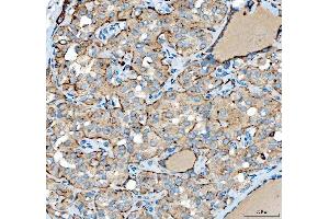 IHC analysis of SIAE using anti-SIAE antibody (ABIN7600774). (SIAE antibody  (AA 230-523))