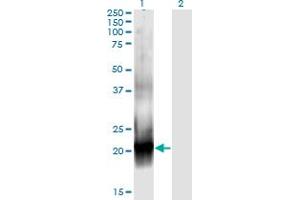Western Blot analysis of RAC2 expression in transfected 293T cell line by RAC2 monoclonal antibody (M08), clone 3B8. (RAC2 antibody  (AA 1-192))