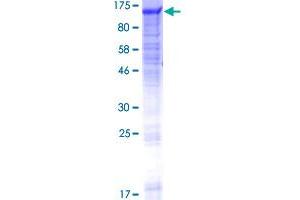 Image no. 1 for Glucosidase, Alpha, Neutral C (GANC) (AA 1-914) protein (GST tag) (ABIN1354781)