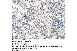 Rabbit Anti-NXF3 Antibody  Paraffin Embedded Tissue: Human Kidney Cellular Data: Epithelial cells of renal tubule Antibody Concentration: 4. (NXF3 antibody  (C-Term))