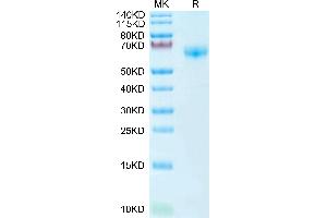 Mouse PD-1 on Tris-Bis PAGE under reduced condition. (PD-1 Protein (AA 25-167) (Fc Tag))