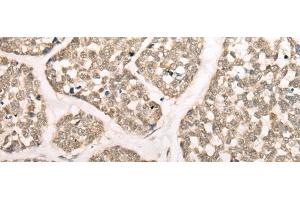 Calpain 15/SOLH antibody