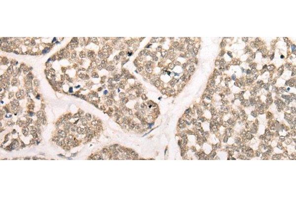 Calpain 15/SOLH antibody