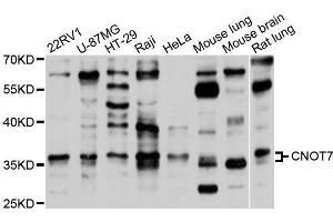Western blot analysis of extracts of various cell lines, using CNOT7 antibody (ABIN5995835) at 1/1000 dilution.