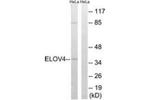 Western Blotting (WB) image for anti-ELOVL Fatty Acid Elongase 4 (ELOVL4) (AA 41-90) antibody (ABIN2890303) (ELOVL4 antibody  (AA 41-90))