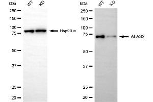 Western blotting analysis using ALAS2 antibody (ABIN7797591). (Recombinant ALAS2 antibody)