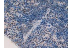 Detection of C1qA in Mouse Spleen Tissue using Polyclonal Antibody to Complement Component 1, Q Subcomponent A (C1qA) (C1QA antibody  (AA 23-245))