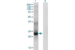 Western Blot analysis of TSPAN8 expression in transfected 293T cell line by TSPAN8 monoclonal antibody (M02), clone 1E5. (Tspan-8 antibody  (AA 110-205))