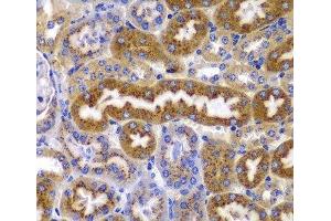 Immunohistochemistry of paraffin-embedded Mouse kidney using PRKAB1 Polyclonal Antibody at dilution of 1:100 (40x lens). (PRKAB1 antibody)