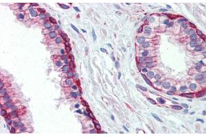 Immunohistochemistry with Human Prostate lysate tissue at an antibody concentration of 5. (UBE2L3 antibody  (C-Term))
