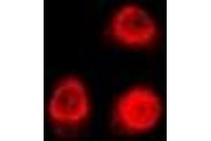Immunofluorescent analysis of Uev1A staining in U2OS cells. (UBE2V1 antibody)