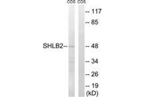 Western blot analysis of extracts from COS7 cells, using SH3GLB2 Antibody. (SH3GLB2 antibody  (AA 131-180))