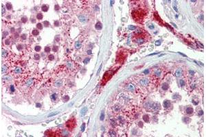 Human Testis (formalin-fixed, paraffin-embedded) stained with SOX17 antibody ABIN462221 followed by biotinylated goat anti-rabbit IgG secondary antibody ABIN481713, alkaline phosphatase-streptavidin and chromogen. (SOX17 antibody  (C-Term))