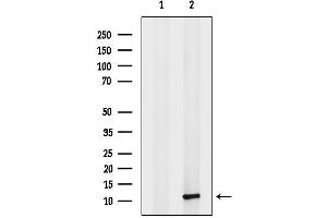 anti-Chemokine (C-C Motif) Ligand 13 (CCL13) antibody