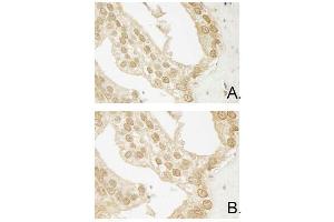 Immunohistochemistry (IHC) image for anti-V-Akt Murine Thymoma Viral Oncogene Homolog 3 (Protein Kinase B, Gamma) (AKT3) (Internal Region) antibody (FITC) (ABIN5596898)