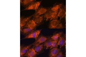 Immunofluorescence analysis of C6 cells using IPO4 antibody  at dilution of 1:100. (Importin 4 antibody  (AA 728-1081))