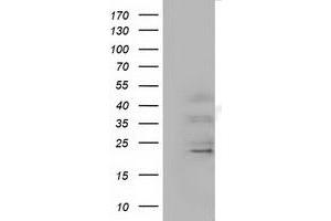 Western Blotting (WB) image for anti-Ephrin A2 (EFNA2) antibody (ABIN1497958)