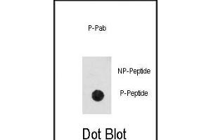 Dot blot analysis of anti-Phospho-CDK2-pT14 Antibody (ABIN389996 and ABIN2839773) on nitrocellulose membrane. (CDK2 antibody  (pThr14))