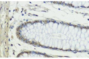 Immunohistochemistry (Paraffin-embedded Sections) (IHC (p)) image for anti-SNAIL (SNAI1) antibody (ABIN7261213)