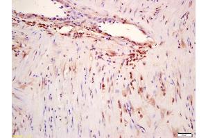 Formalin-fixed and paraffin embedded human myometrium labeled with Anti-phospho-ERK5 (Ser496) Polyclonal Antibody, Unconjugated (ABIN710246) at 1:200 followed by conjugation to the secondary antibody and DAB staining (MAPK7 antibody  (pSer496))