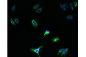 Immunofluorescent analysis of HepG2 cells using ABIN7168735 at dilution of 1:100 and Alexa Fluor 488-congugated AffiniPure Goat Anti-Rabbit IgG(H+L) (SCAMP5 antibody  (AA 170-235))