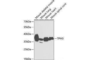 Western blot analysis of extracts of various cell lines using TPM3 Polyclonal Antibody at dilution of 1:1000. (TPM3 antibody)